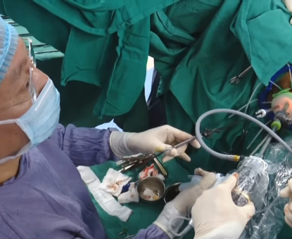  Phẫu thuật nội soi cắt trực tràng qua đường hậu môn(TaTME)